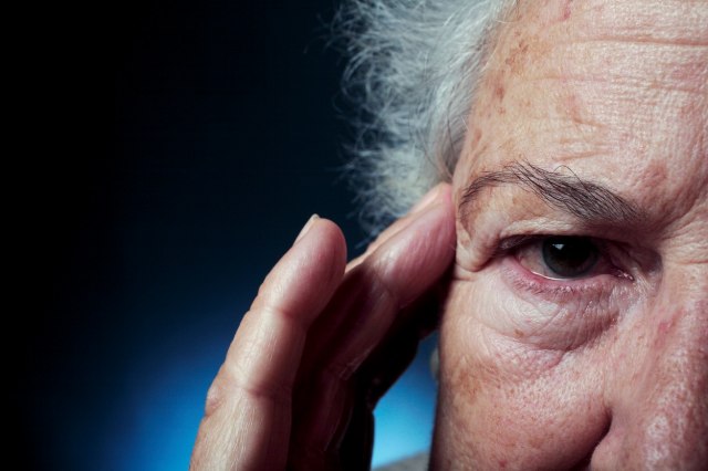 Magnetna rezonanca je pokazala šta migrena radi mozgu: "Jedno od najtežih stanja"